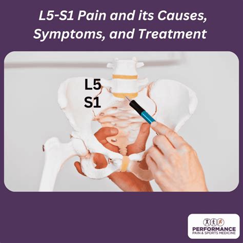 Image result for L5 Bulging Disc Exercises