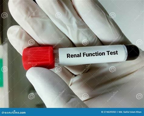 Blood Sample for Renal Function Test. GFR, EGFR, Creatinine, Bun Stock ...