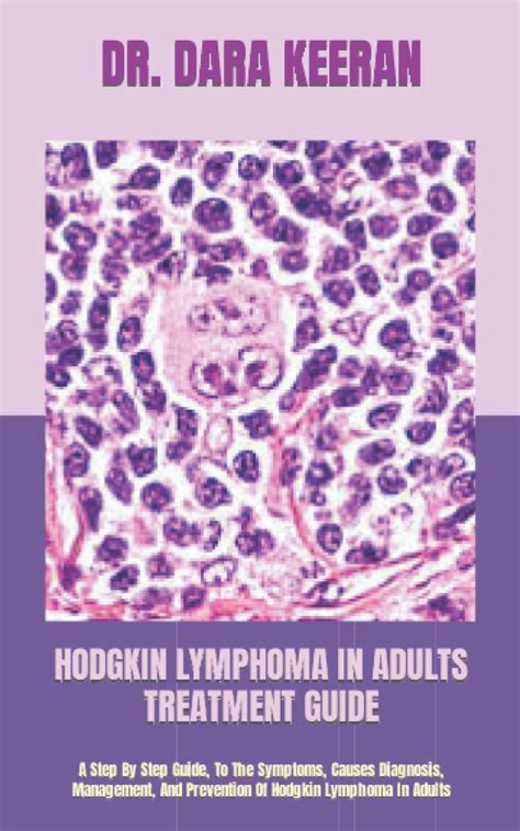 Hodgkin Lymphoma In Adults Treatment Guide A Step By Step | Desertcart ...