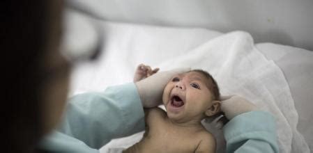 La OMS alerta de miles de casos de microcefalia por el zika