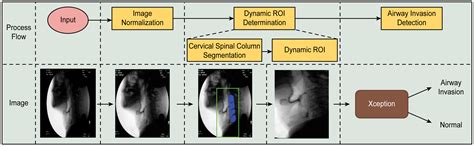 Modified Barium Swallow Assessment