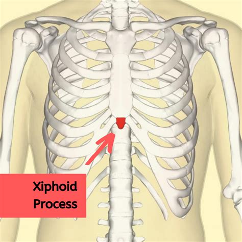 Xiphoid Process Problems 的图像结果