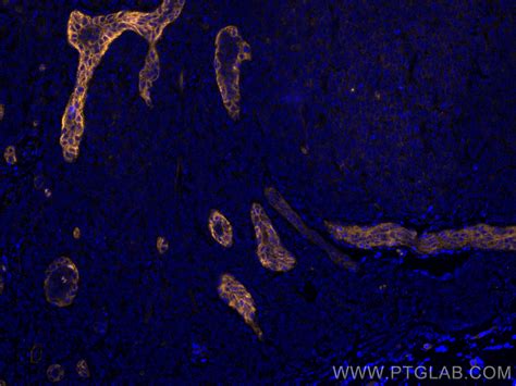 Endoglin/CD105 antibody (CL555-67075) | Proteintech