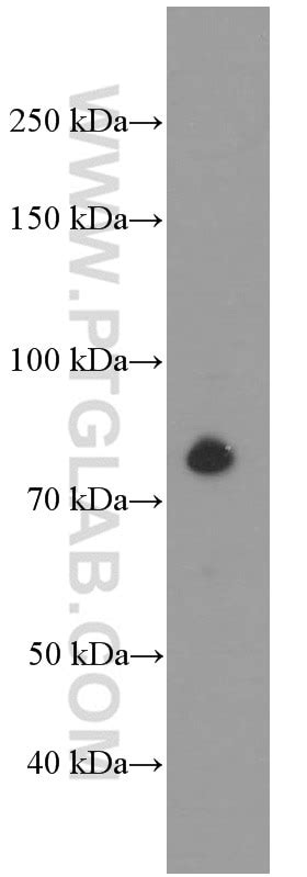 PLAA antibody (60244-1-Ig) | Proteintech