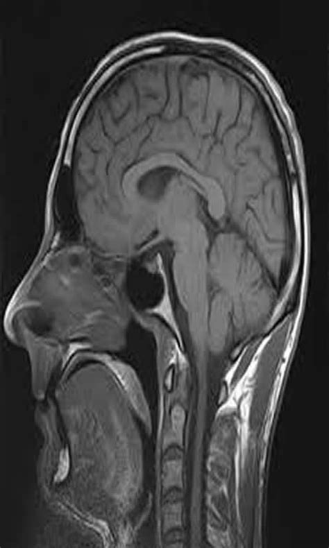 About of MRI - App on Amazon Appstore