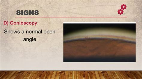 Primary open angle glaucoma | PPTX