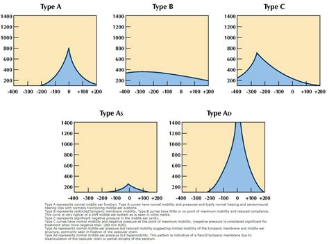 Tympanogram Types And Meanings at William Everhart blog