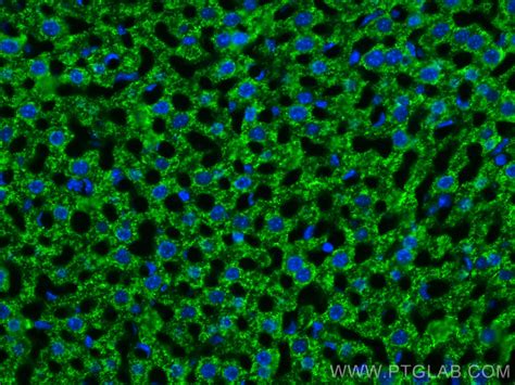 Arginase-1 antibody (66129-1-Ig) | Proteintech