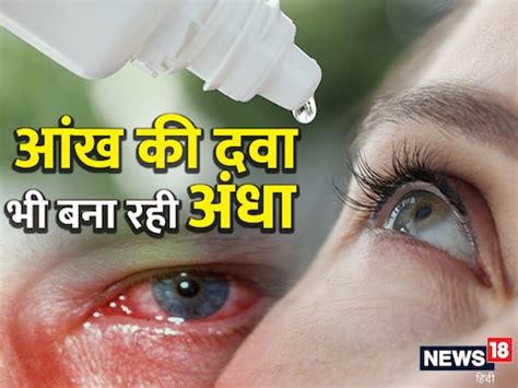 Glaucoma steroid eye drops can lead to glaucoma risk in diabetic high ...