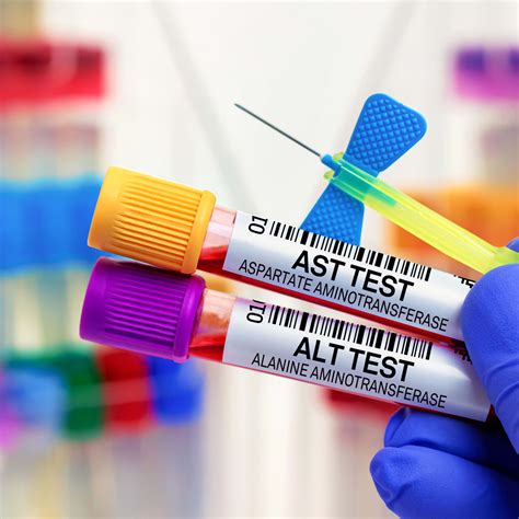 Ashley Tisdale Weighs in on Possible 'Suite Life' Reboot