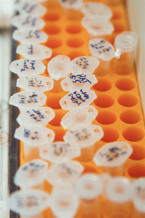 Image result for Paternity Testing Procedure