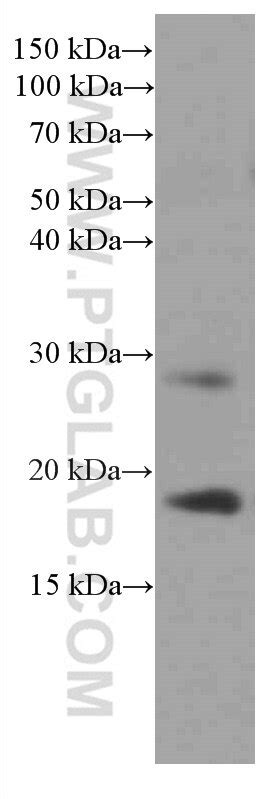 Myosin Light Chain 2/MLC-2V antibody (60229-1-Ig) | Proteintech