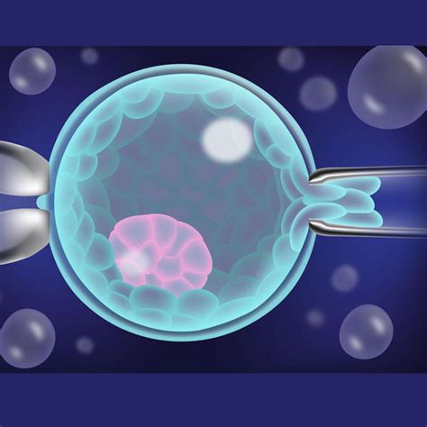 Live Birth with or without Preimplantation Genetic Testing for Aneuploidy
