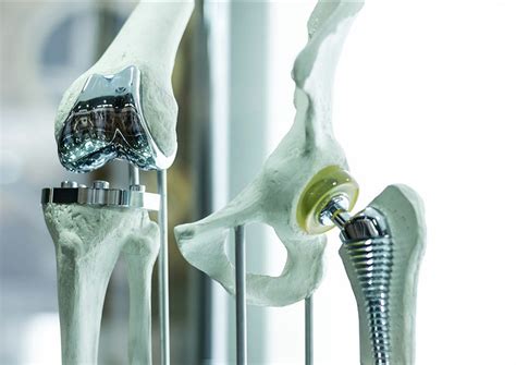 Damage analysis for your components and component groups ️