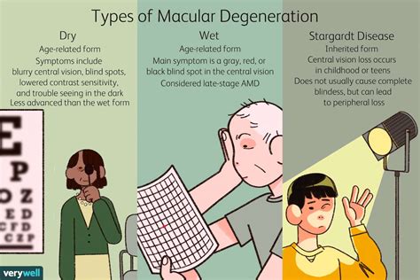 Image result for Macular Degeneration Vision Examples