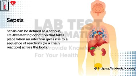 Sepsis Disease