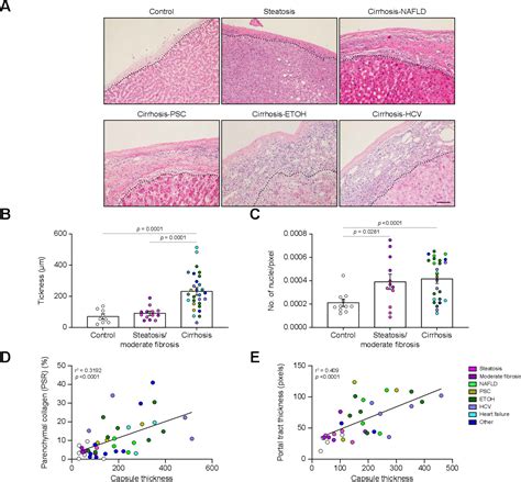 Figure 5 from Glisson’s capsule matrix structure and function is altered in patients with ...