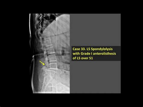 Gallery - drkalirajanscans-Pregnancy Scan Centre Kumbakonam