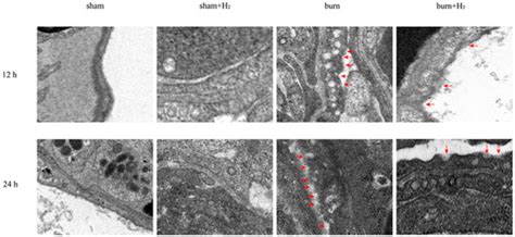 Effect of Hydrogen on AM Pyroptosis Induced by Severe Burns in Rats
