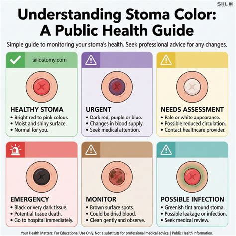 Stoma Color, What’s Normal, What’s Not, And When To Get Help