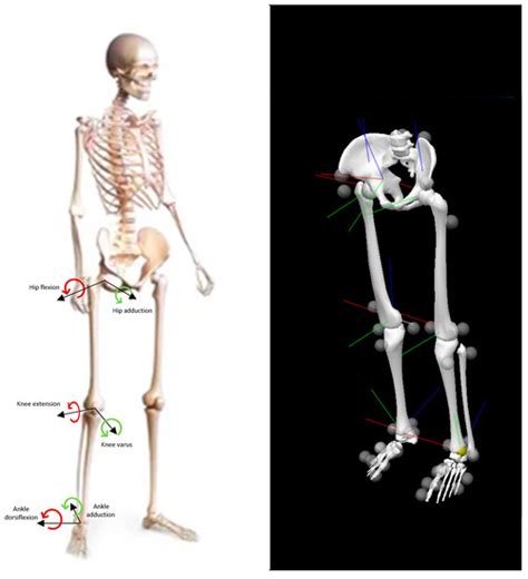 IJERPH | Special Issue : Musculoskeletal Physiotherapy and Rehabilitation