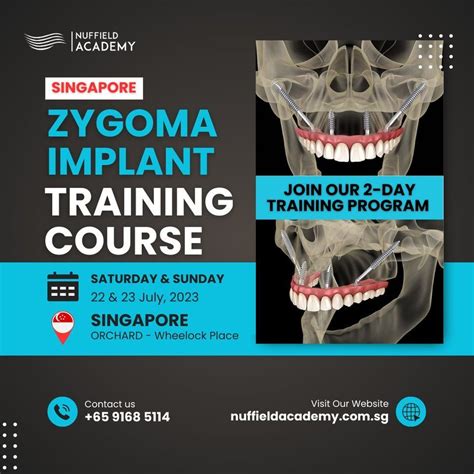 Zygomatic Dental Implant Surgery Course Singapore, Nuffield Dental ...