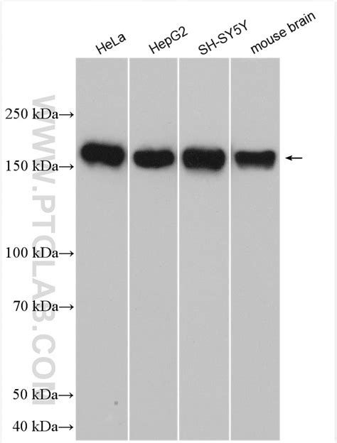 POGZ antibody (30106-1-AP) | Proteintech