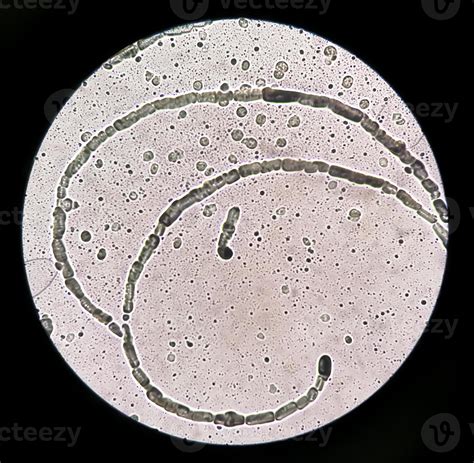 Microscopic Fungus How Fungi Make Potent Toxins That Can Contaminate