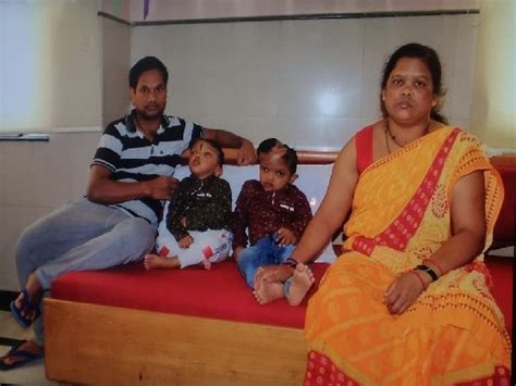Delhi: Craniopagus twins to return to home state after successful ...