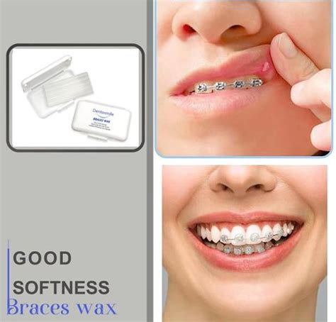 Dentosmile Dental Orthodontic Wax for Braces / Bracket Gum - 5 Strips ...