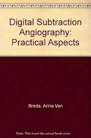 Buy Digital Subtraction Angiography: Practical Aspects Book Online at ...