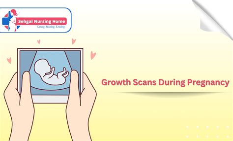 Understanding The Importance Of Growth Scans During Pregnancy