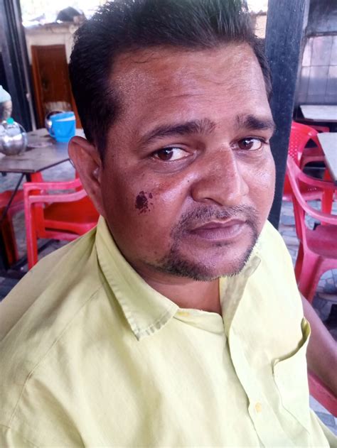 In Vapi, the son was chased by a dog and the father was caught running ...