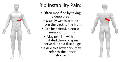 What is Slipping Rib Syndrome? - Regenexx