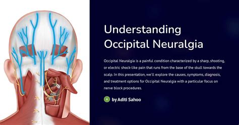 Understanding Occipital Neuralgia