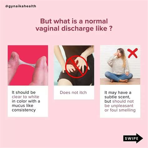 Vaginal Discharge Normal Vs Not Normal
