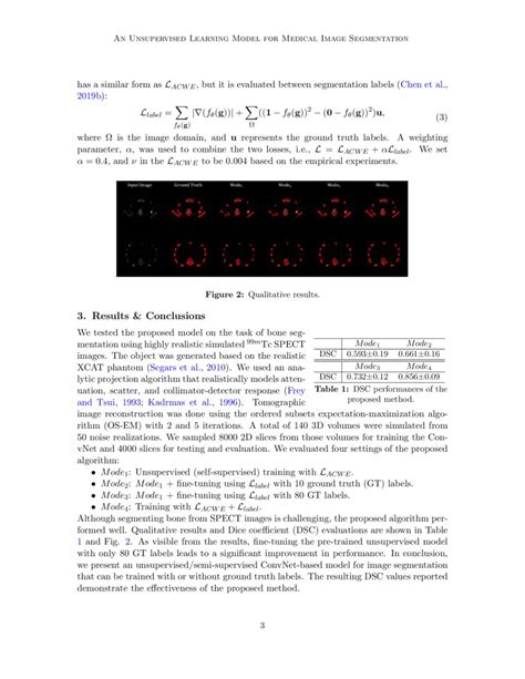 Image result for Image Segmentation Using Unsupervised Learning