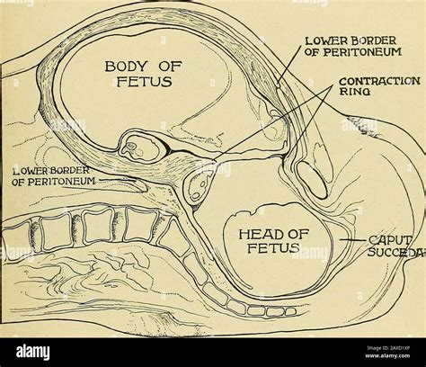 The practice of obstetrics, designed for the use of students and ...