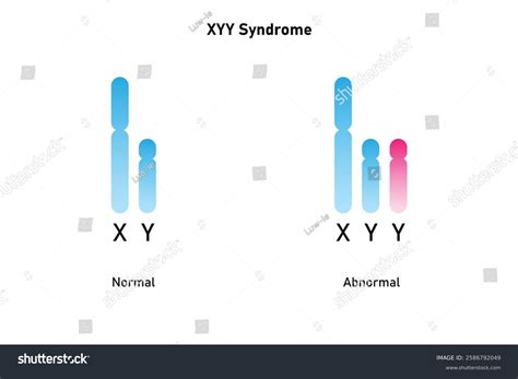 Xyy Syndrome Science Design Vector Illustration Stock Vector (Royalty Free) 2586792049 ...