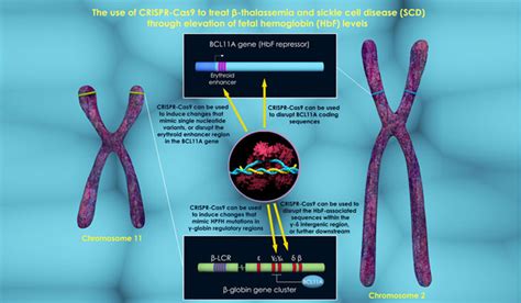 World Thalassemia Day: What you should know about this blood condition ...