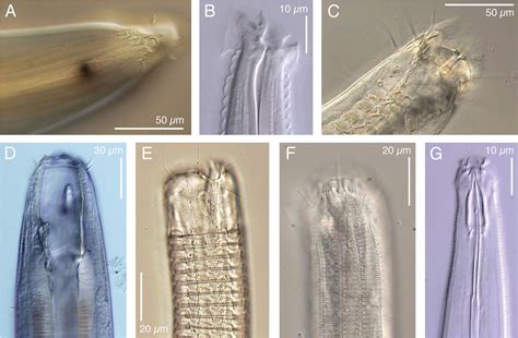 Class Nematoda Examples at Kristie Cummings blog