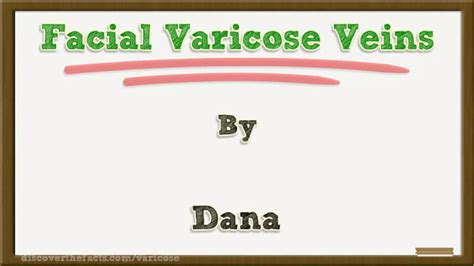 Facial Varicose Veins | ODP