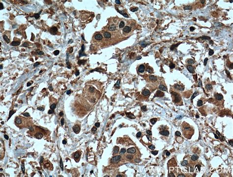 Tubulin Beta Class V antibody (66362-1-Ig) | Proteintech