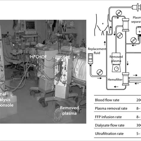 CRRT Recirculation 的图像结果