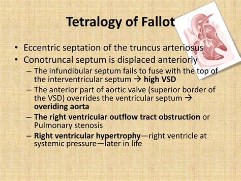 The boot shaped heart sign | PPTX