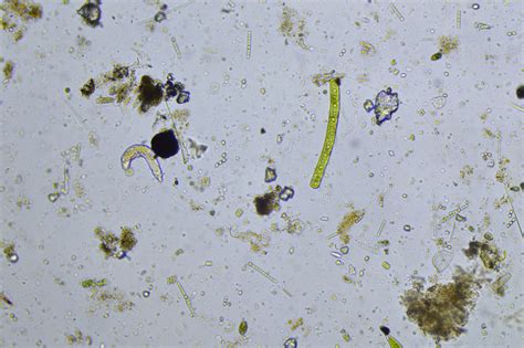 Pond Water Organisms Under Microscope