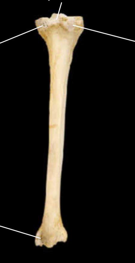 Image result for Ribstride Tibia