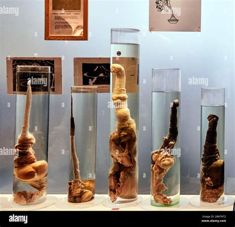 Reykjavik, The Icelandic Phallological Museum is probably the only ...