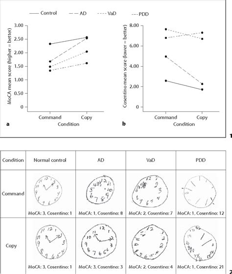 Moca Test Online 的图像结果