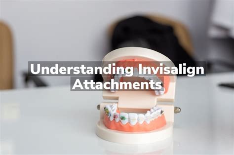 Understanding Invisalign Attachments